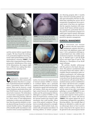 sive throwing program after 3 months
                                                                                                                      that is directed toward the patients’ spe-
                                                                                                                      ciﬁc sport and position. We have no pub-
                                                                                                                      lished data regarding the success rate of
                                                                                                                      nonoperative management; but as previ-
                                                                                                                      ously stated, it has been our experience
                                                                                                                      that the majority of patients with symp-
                                                                                                                      tomatic SLAP lesions will fail conserva-
                                                                                                                      tive management, particularly throwers.
                                                                                                                      The goal of a nonoperative program is to
                                                                                                                      reduce pain, improve motion, and restore
                                                                                                                      strength in patients who do not wish to
            Magnetic resonance arthrography                            Arthroscopic view of a right shoulder,
                                                                                                                      proceed to operative management.
 in abduction and external rotation (ABER),                 demonstrating a type II SLAP lesion. A probe has
 demonstrating an articular partial thickness               entered the joint via the standard anterior interval
 rotator cuff tear (white arrow). We prefer this view       portal and is used to conﬁrm the diagnosis.
 in suspected cases of associated cuff pathology
 because it allows for better visualization of the


                                                                                                                      O
                                                                                                                             ur indications for surgery
 articular surface, labrum, and is helpful in detecting                                                                      are patients who fail conservative
 intratendinous lesions.
                                                                                                                             management, patients who have a
                                                                                                                      SLAP lesion with signiﬁcant rotator cuff
and the anterior inferior capsule-labrum                                                                              tears ( 50%), and patients with large as-
complex. We have found this technique                                                                                 sociated labral tears who exhibit severe
to be particularly helpful in detecting ar-                                                                           mechanical symptoms. Generally speak-
ticular-sided partial thickness tears with                                                                            ing, we debride types I and III SLAP
intratendinous extension (           ). We                                                                            lesions and repair types II and IV. The
believe this is important because without                                                                             following is a description of our SLAP
preoperative identiﬁcation of the extent                                                                              repair technique.
                                                                        Once the SLAP lesion has been conﬁrmed,
of the delamination, the surgeon might                                                                                    We perform shoulder arthroscopy
                                                            a second anterior lateral portal (blue cannula) is
have a difficult time making that deter-                    created, which will be the working portal for repairing   with the patient in the beach chair po-
mination in the operating room.                             the SLAP lesion. Establishing the proper position of      sition. The patient is anesthetized under
                                                            this portal is crucial because the angle at which the     intrascalene block with sedation. After a
                                                            suture anchor is inserted is completely dependent         complete clinical examination under an-
                                                            upon the location of the portal. We avoid penetrating
                                                                                                                      esthesia is performed, a 30° arthroscope
                                                            the rotator cuff in creating this portal, especially in
                                                            throwing athletes.                                        (Smith & Nephew Dyonics, Andover, MA)
                                                                                                                      is introduced into the glenohumeral joint

C
      onservative management of
      SLAP lesions is often unsuccessful,                  motion. An excessive loss of glenohumer-                   via the posterior soft-spot portal. Then, a
      particularly when there is a compo-                  al internal rotation (GIRD) is common                      standard anterior portal is established in
nent of glenohumeral joint instability or                  in overhead athletes and a particular                      the rotator cuff interval and a complete
when a concomitant rotator cuff tear is                    emphasis should be placed on stretching                    diagnostic arthroscopy is performed. A
present. There may be, however, a small                    the posterior capsule and restoring inter-                 probe is used to conﬁrm a SLAP lesion
subset of patients, particularly those with                nal rotation, which may prevent patho-                     and the extent of any other concomitant
type I SLAP lesions, who are amenable to                   logic contact between the supraspinatus                    pathology is assessed (         ). In cases
conservative treatment. The initial phase                  tendon and the posterosuperior labrum.                     of an isolated repairable SLAP lesion, a
of conservative management consists of                     Although it is unclear if GIRD is a risk                   second anterosuperior lateral portal is
cessation of throwing activities, followed                 factor for SLAP lesions, restoring shoul-                  established in the rotator cuff interval
by a short course of anti-inﬂammatory                      der internal rotation may improve path-                    (        ). We caution against the use of
medication to reduce pain and inﬂamma-                     omechanics that could possibly reduce                      a transrotator cuff approach, especially in
tion. Once the pain has subsided, we initi-                some of the patient’s symptoms. The pa-                    throwing athletes. Any unstable ﬂaps of
ate physical therapy focused on restoring                  tient is eventually advanced to a strength-                labrum are debrided to a stable rim, and
normal shoulder motion. Strengthening                      ening phase, which includes trunk, core,                   an arthroscopic shaver or burr is used to
of the shoulder girdle musculature is also                 rotator cuff, and scapular musculature. In                 create a bony bed at the superior rim of
crucial to restore normal scapulothoracic                  throwing athletes, we initiate a progres-                  the glenoid via the anterosuperior lateral


                                                     journal of orthopaedic & sports physical therapy | volume 39 | number 2 | february 2009 | 75
 