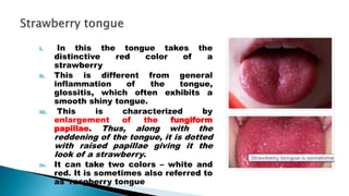 Tongue Raspberry Lesions of oral cavity | PPTX