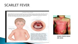 Lesions of oral cavity | PPTX