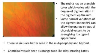 Lesions of retina | PPTX