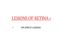 LESIONS OF RETINA 1
• DR SHRUTI LADDHA
 
