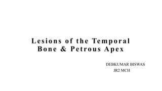 Lesions of the Temporal
Bone & Petrous Apex
DEBKUMAR BISWAS
JR2 MCH
 