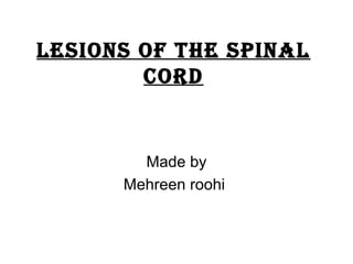 Lesions of the spinaL
cord
Made by
Mehreen roohi
 