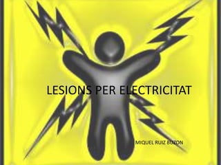 LESIONS PER ELECTRICITAT
MIQUEL RUIZ BUZON
 