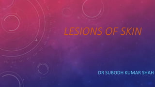 LESIONS OF SKIN
DR SUBODH KUMAR SHAH
 
