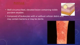 Lesion of skin | PPTX