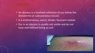Lesion of skin | PPTX