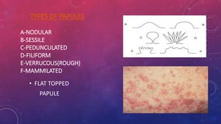 Lesion of skin | PPTX