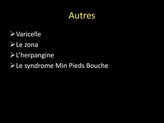 Autres
Varicelle
Le zona
L’herpangine
Le syndrome Min Pieds Bouche
 