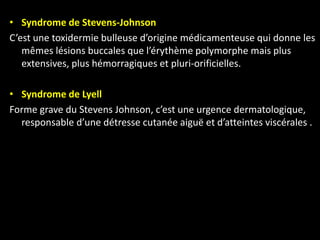 • Syndrome de Stevens-Johnson
C’est une toxidermie bulleuse d’origine médicamenteuse qui donne les
mêmes lésions buccales que l’érythème polymorphe mais plus
extensives, plus hémorragiques et pluri-orificielles.
• Syndrome de Lyell
Forme grave du Stevens Johnson, c’est une urgence dermatologique,
responsable d’une détresse cutanée aiguë et d’atteintes viscérales .
 