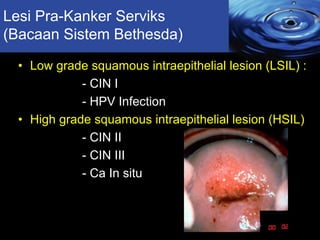 Lesi Pra-Kanker Serviks
(Bacaan Sistem Bethesda)
• Low grade squamous intraepithelial lesion (LSIL) :
- CIN I
- HPV Infect...