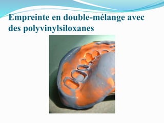 Empreinte en double-mélange avec
des polyvinylsiloxanes
 
