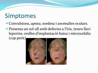 SímptomesConvulsions, apnea, sordesa i anomalies oculars.Presenta un sol ull amb defectes a l’iris, tenen llavi leporins, orelles d’implantació baixa i microcefalia (cap petit)