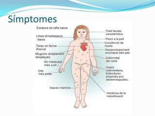 Símptomes