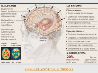 VIDEO – EL AZOTE DEL ALZHEIMER
 