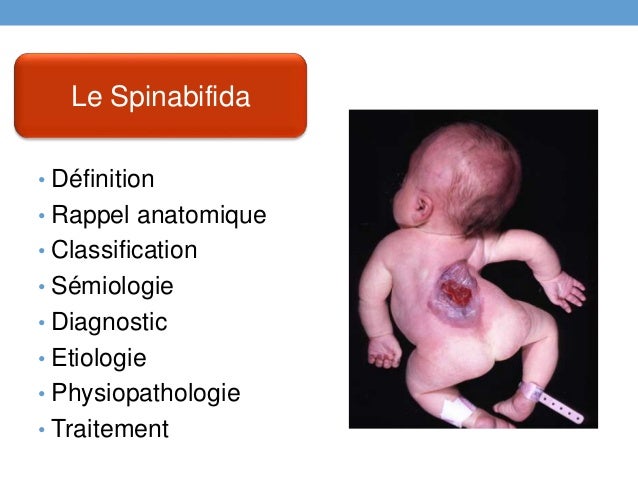 les malformations congenitales du systeme nerveux central