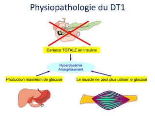 Le muscle ne peut plus utiliser le glucoseProduction maximum de glucose
Hyperglycémie
Amaigrissement
Carence TOTALE en Insuline
Physiopathologie du DT1
 