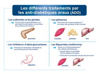 foiemuscles
• Les inhibiteurs d’alpha-glucosidases
Ce sont des insulinosécréteurs, qui
permettent la stimulation du pancréas
pour produire de l’insuline
Les différents traitements par
les anti-diabétiques oraux (ADO)
graisses
• Les sulfamides et les glinides
Freinage de l’absorption intestinale du
sucre provenant de l’alimentation
• Les Biguanides (metformine)
Action sur l’insulinorésistance(1)
des cellules périphériques :
 augmentation la sensibilité
de ces cellules à l’insuline
 diminution la production de glucose par le foie
• Les glitazones
Diminution de l’insulinorésistance(1)
au niveau des graisses et des muscles
foiemusclespancréas
digestion
 