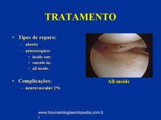 www.traumatologiaeortopedia.com.b
r
 