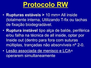 Protocolo RW
• Rupturas estáveis > 10 mm= All inside
(totalmente interna, Utilizando T-fix ou tachas
de fixação biodegradável.
• Ruptura instável tipo alça de balde, periférica
e/ou falha na técnica de all inside, optar por
Inside out (dentro para fora com suturas
múltiplas, trançadas não absorvíveis nº 2-0.
• Lesão associada de menisco e LCA=
operarem simultaneamente
 