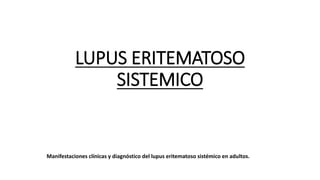 LUPUS ERITEMATOSO
SISTEMICO
Manifestaciones clínicas y diagnóstico del lupus eritematoso sistémico en adultos.
 