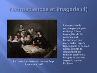 La Leçon d'anatomie du docteur Tulp,
Rembrandt, 1632
L'observation du
cerveau par autopsie
était imprécise et
incomplète, du fait
notamment de
l'observation post
mortem d'un organe
figé, laquelle ne pouvait
rendre compte du
déplacement des
tumeurs cérébrales à
l'origine de troubles
cognitifs, comme
l'aphasie
 