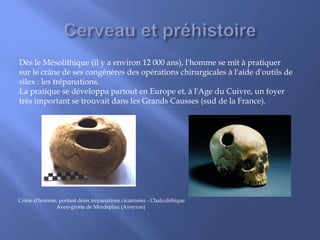 Dès le Mésolithique (il y a environ 12 000 ans), l'homme se mit à pratiquer
sur le crâne de ses congénères des opérations chirurgicales à l'aide d'outils de
silex : les trépanations.
La pratique se développa partout en Europe et, à l'Age du Cuivre, un foyer
très important se trouvait dans les Grands Causses (sud de la France).
Crâne d'homme, portant deux trépanations cicatrisées - Chalcolithique
Aven-grotte de Merdeplau (Aveyron)
 