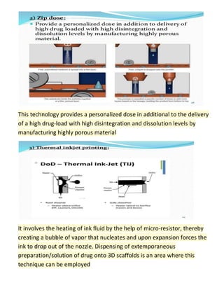 This technology provides a personalized dose in additional to the delivery
of a high drug-load with high disintegration and dissolution levels by
manufacturing highly porous material
It involves the heating of ink fluid by the help of micro-resistor, thereby
creating a bubble of vapor that nucleates and upon expansion forces the
ink to drop out of the nozzle. Dispensing of extemporaneous
preparation/solution of drug onto 3D scaffolds is an area where this
technique can be employed
 
