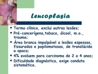 Leucoplasia
 Termo   clínico, exclui outras lesões;
 Pré-cancerígena,tabaco, álcool, m.o.,
  trauma;
 Área branca impalpável a lesões espessas,
  fissuradas e papilomatosas, de translúcida
  a opaca;
 4% evoluem para carcinoma de 2 a 4 anos;
 Dificuldade diagnóstica, exige conduta
  sistemática.
 