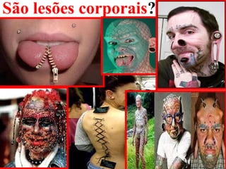 São lesões corporais?
 