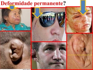 Deformidade permanente?
 