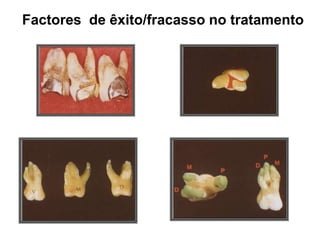 Factores de êxito/fracasso no tratamento

 