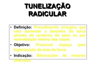 TUNELIZAÇÃO
RADICULAR
• Definição: Procedimento cirúrgico que
visa aumentar o tamanho da furca
através do contorno do osso ou por
remodelação interna das raízes.
• Objetivo:
Promover
espaço
para
higienização da área da furca
• Indicação:
inferiores

Bifurcações

de

molares

 
