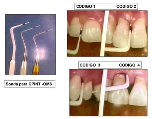CODIGO 1

CODIGO 3

Sonda para CPINT -OMS

CODIGO 2

CODIGO 4

 