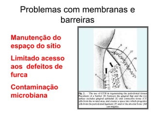 Problemas com membranas e
barreiras
Manutenção do
espaço do sítio

Limitado acesso
aos defeitos de
furca
Contaminação
microbiana

 