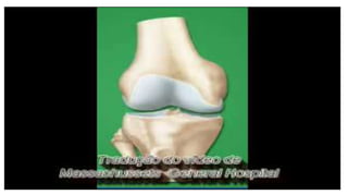 Lesão do cruzado anterior