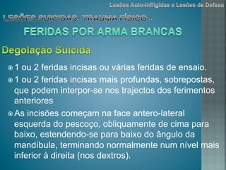 ž 1 ou 2 feridas incisas ou várias feridas de ensaio.
ž 1 ou 2 feridas incisas mais profundas, sobrepostas,
que podem interpor-se nos trajectos dos ferimentos
anteriores
ž As incisões começam na face antero-lateral
esquerda do pescoço, obliquamente de cima para
baixo, estendendo-se para baixo do ângulo da
mandíbula, terminando normalmente num nível mais
inferior à direita (nos dextros).
 