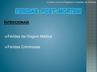 ž Feridas de Origem Médica
ž Feridas Criminosas
INTENCIONAIS
 
