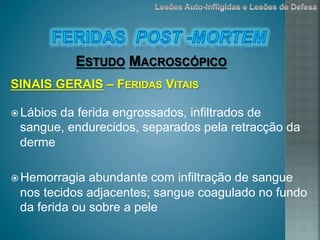 ž Lábios da ferida engrossados, infiltrados de
sangue, endurecidos, separados pela retracção da
derme
ž Hemorragia abundante com infiltração de sangue
nos tecidos adjacentes; sangue coagulado no fundo
da ferida ou sobre a pele
ESTUDO MACROSCÓPICO
SINAIS GERAIS – FERIDAS VITAIS
 