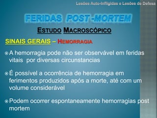 ž A hemorragia pode não ser observável em feridas
vitais por diversas circunstancias
ž É possível a ocorrência de hemorragia em
ferimentos produzidos após a morte, até com um
volume considerável
ž Podem ocorrer espontaneamente hemorragias post
mortem
ESTUDO MACROSCÓPICO
SINAIS GERAIS – HEMORRAGIA
 