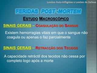 Existem hemorragias vitais em que o sangue não
coagula ou apenas o faz parcialmente
ESTUDO MACROSCÓPICO
SINAIS GERAIS – COAGULAÇÃO DO SANGUE
A capacidade retráctil dos tecidos não cessa por
completo logo após a morte
SINAIS GERAIS – RETRACÇÃO DOS TECIDOS
 