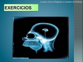 Lesões auto infligidas