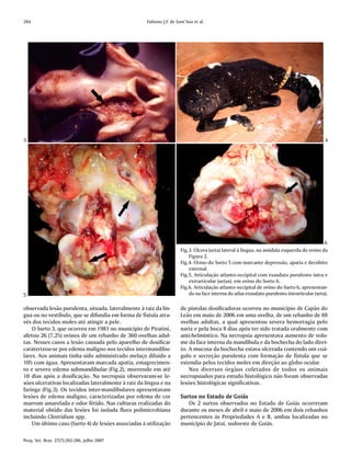 284                                                 Fabiano J.F. de Sant’Ana et al.




3                                                                                                                                           4




                                                                                                                                            6
                                                                      Fig.3. Úlcera (seta) lateral à língua, na amídala esquerda do ovino da
                                                                          Figura 2.
                                                                      Fig.4. Ovino do Surto 5 com marcante depressão, apatia e decúbito
                                                                          esternal.
                                                                      Fig.5. Articulação atlanto-occipital com exsudato purulento intra e
                                                                          extrarticular (setas), em ovino do Surto 6.
                                                                      Fig.6. Articulação atlanto-occipital de ovino do Surto 6, apresentan-
5                                                                         do na face interna do atlas exsudato purulento intrarticular (seta).

observada lesão purulenta, situada, lateralmente à raiz da lín-       de pistolas dosificadoras ocorreu no município de Capão do
gua ou no vestíbulo, que se difundia em forma de fístula atra-        Leão em maio de 2006 em uma ovelha, de um rebanho de 88
vés dos tecidos moles até atingir a pele.                             ovelhas adultas, a qual apresentou severa hemorragia pelo
    O Surto 3, que ocorreu em 1981 no município de Piratiní,          nariz e pela boca 8 dias após ter sido tratada oralmente com
afetou 26 (7,2%) ovinos de um rebanho de 360 ovelhas adul-            anti-helmíntico. Na necropsia apresentava aumento de volu-
tas. Nesses casos a lesão causada pelo aparelho de dosificar          me da face interna da mandíbula e da bochecha do lado direi-
caraterizou-se por edema maligno nos tecidos intermandibu-            to. A mucosa da bochecha estava ulcerada contendo um coá-
lares. Aos animais tinha sido administrado melaço diluído a           gulo e secreção purulenta com formação de fístula que se
10% com água. Apresentaram marcada apatia, emagrecimen-               estendia pelos tecidos moles em direção ao globo ocular.
to e severo edema submandibular (Fig.2), morrendo em até                  Nos diversos órgãos coletados de todos os animais
10 dias após a dosificação. Na necropsia observaram-se le-            necropsiados para estudo histológico não foram observadas
sões ulcerativas localizadas lateralmente à raiz da língua e na       lesões histológicas significativas.
faringe (Fig.3). Os tecidos inter-mandibulares apresentavam
lesões de edema maligno, caracterizadas por edema de cor              Surtos no Estado de Goiás
marrom amarelada e odor fétido. Nas culturas realizadas do               Os 2 surtos observados no Estado de Goiás ocorreram
material obtido das lesões foi isolada flora polimicrobiana           durante os meses de abril e maio de 2006 em dois rebanhos
incluindo Clostridium spp.                                            pertencentes às Propriedades A e B, ambas localizadas no
    Um último caso (Surto 4) de lesões associadas à utilização        município de Jataí, sudoeste de Goiás.

Pesq. Vet. Bras. 27(7):282-286, julho 2007
 