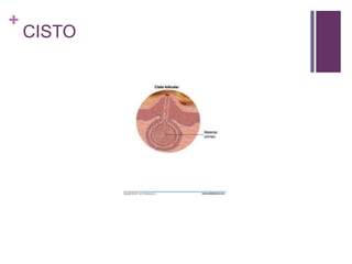 +
CISTO
 