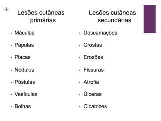 + Lesões cutâneas
secundárias
• Descamações
• Crostas
• Erosões
• Fissuras
• Atrofia
• Úlceras
• Cicatrizes
Lesões cutâneas
primárias
• Máculas
• Pápulas
• Placas
• Nódulos
• Pústulas
• Vesículas
• Bolhas
 