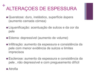 +
ALTERAÇOES DE ESPESSURA
 Queratose: duro, inelástico, superfície áspera
(aumento camada córnea)
 Liquenificação: acentuação de sulcos e da cor da
pele
 Edema: depressível (aumento de volume)
 Infiltração: aumento da espessura e consistência da
pele com menor evidência de sulcos e limites
imprecisos
 Esclerose: aumento da espessura e consistência da
pele , não depressível e com pregueamento difícil
 Atrofia
 