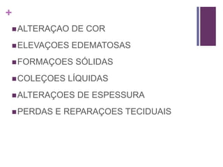 +
ALTERAÇAO DE COR
ELEVAÇOES EDEMATOSAS
FORMAÇOES SÓLIDAS
COLEÇOES LÍQUIDAS
ALTERAÇOES DE ESPESSURA
PERDAS E REPARAÇOES TECIDUAIS
 