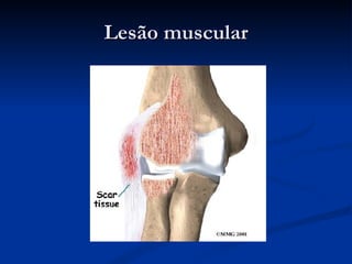 Lesão muscular 