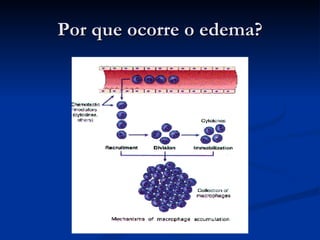 Por que ocorre o edema? 