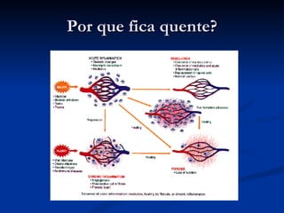 Por que fica quente? 